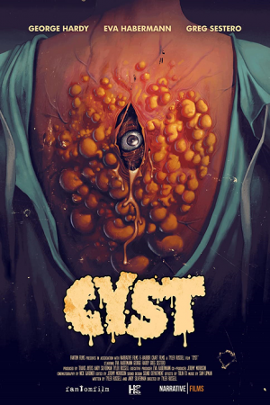 Cyst (2020)